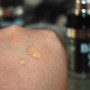 Alternative zu Botox?