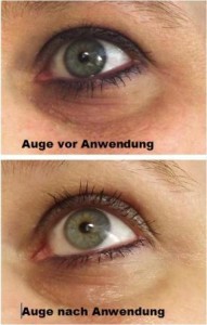 Auge vor und nach der Behandlung Auge vor und nach der Behandlung
