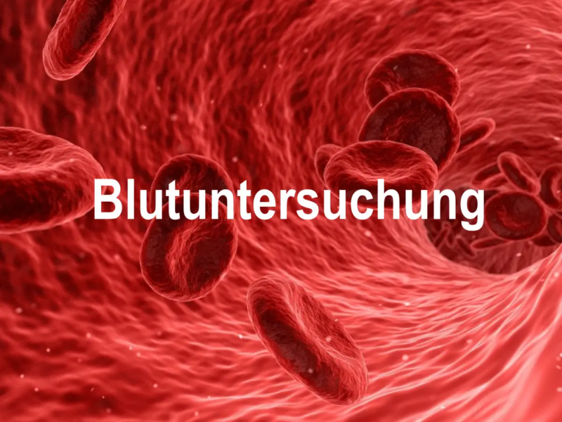 Blutuntersuchung: Warum man sein Blut untersuchen lassen sollte